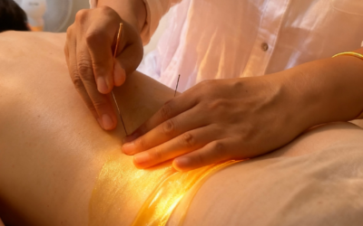 Fasciapuncture® for Burning Buttock Pain — When Relief Comes Unexpectedly