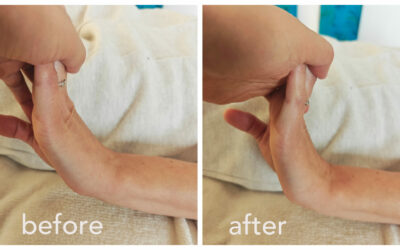 When Wrist Problems Don’t Come From the Wrist – A Fascial Perspective on Hand Numbness, Coldness, and Mobility Loss