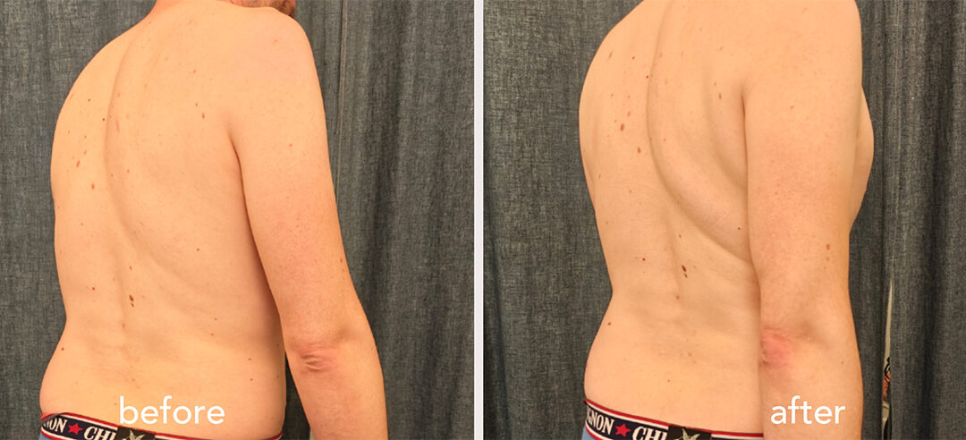 When Movement Changed Before Pain