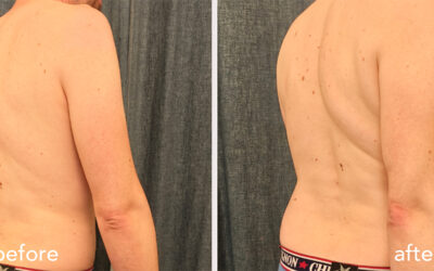 When Movement Changed Before Pain