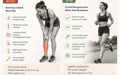 When Shin Pain Is Not a Shin Problem