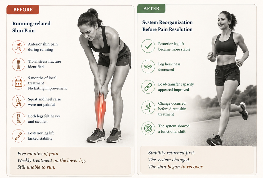 When Shin Pain Is Not a Shin Problem
