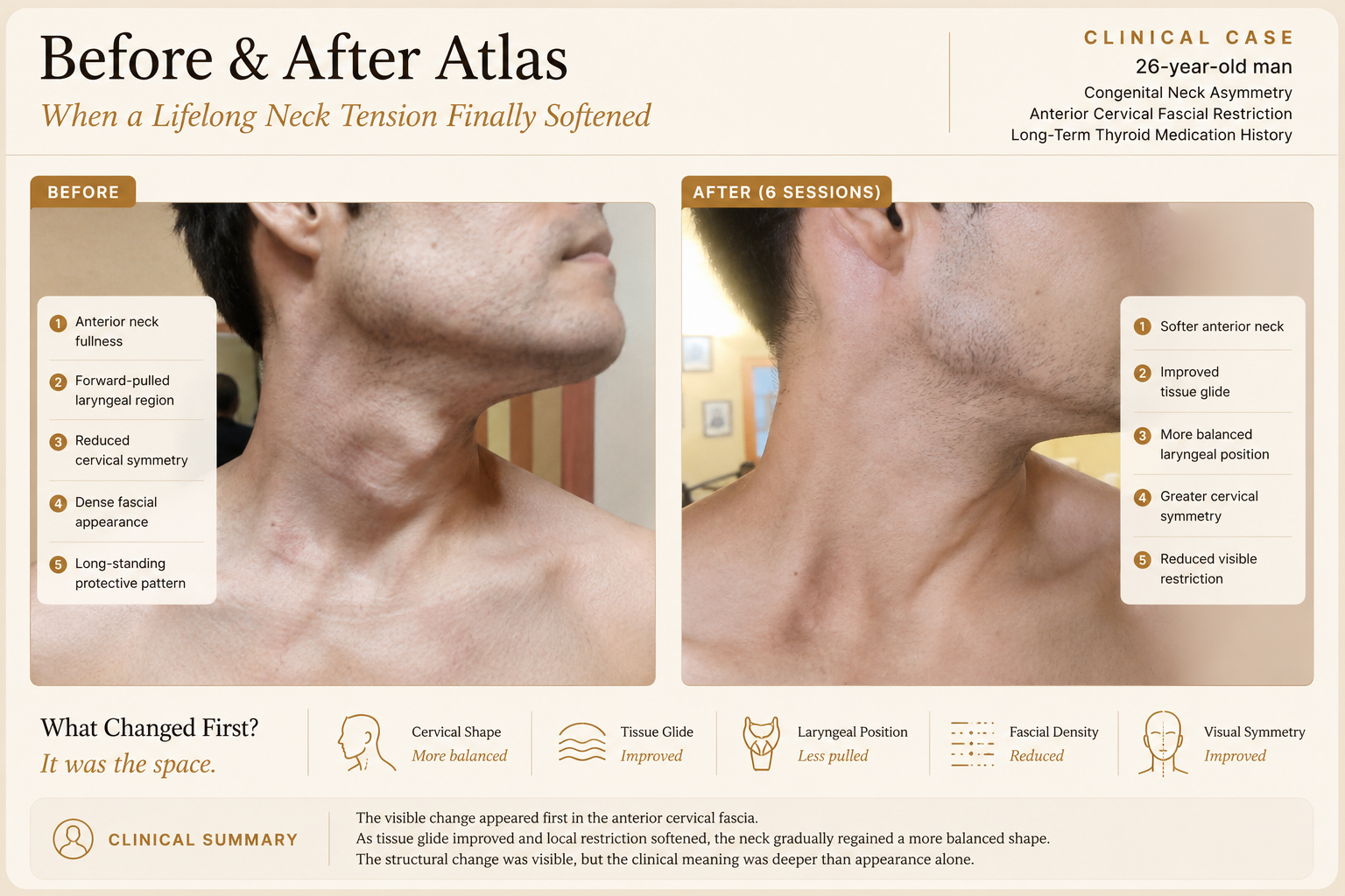 Before and after anterior cervical fascia release clinical case