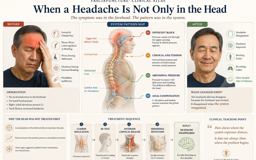 When a Headache Is Not Only in the Head | Fasciapuncture® Clinical Case