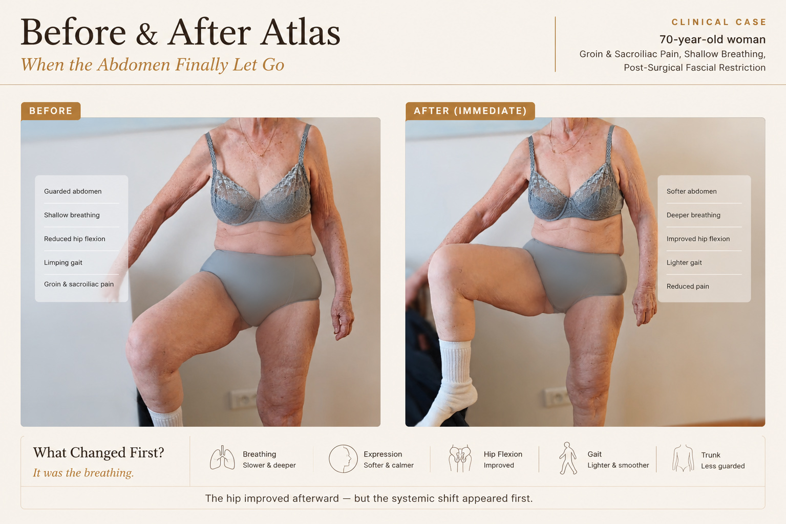 When the Abdomen Finally Let Go clinical atlas