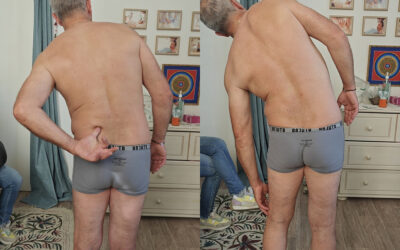 Four Years After Surgery, the Body Began to Move Again
