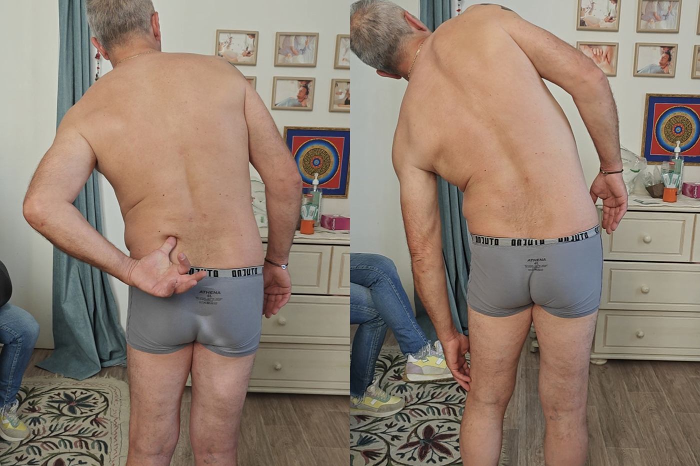 Scar restriction and lower limb movement clinical case