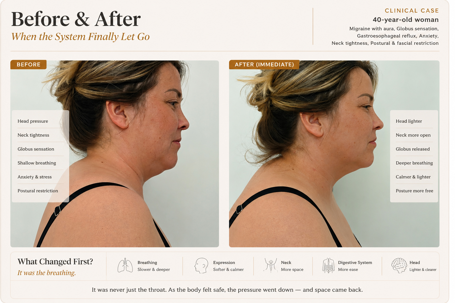 Before and after atlas showing cervical and throat release