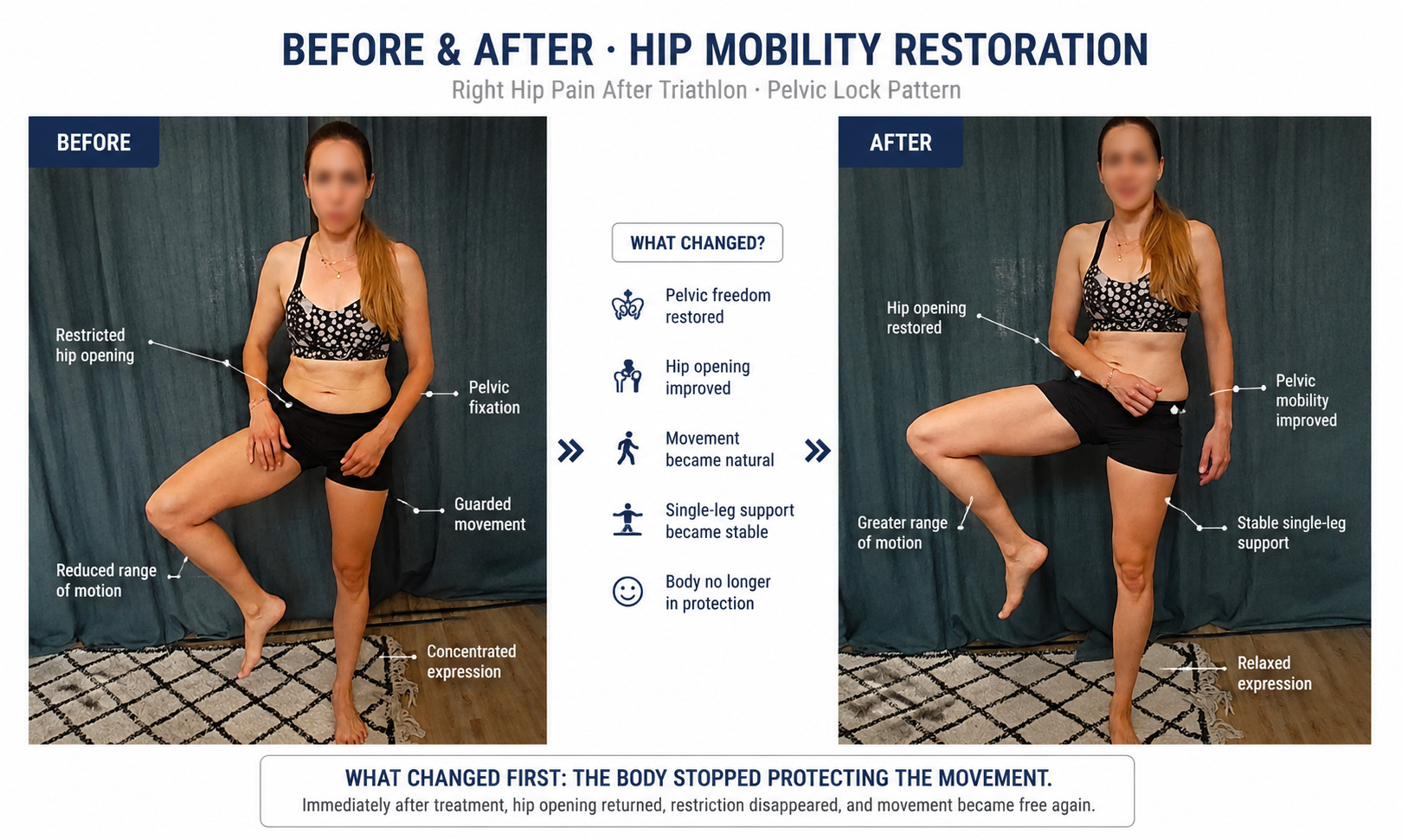 Before and after Fasciapuncture showing restored hip mobility in a triathlete