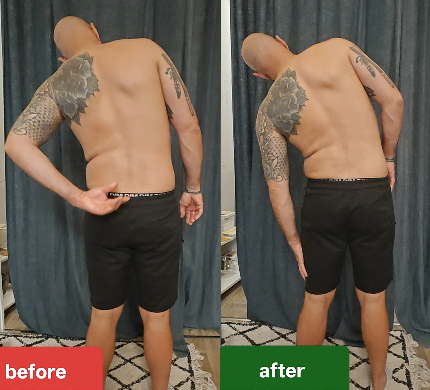Before and after clinical atlas