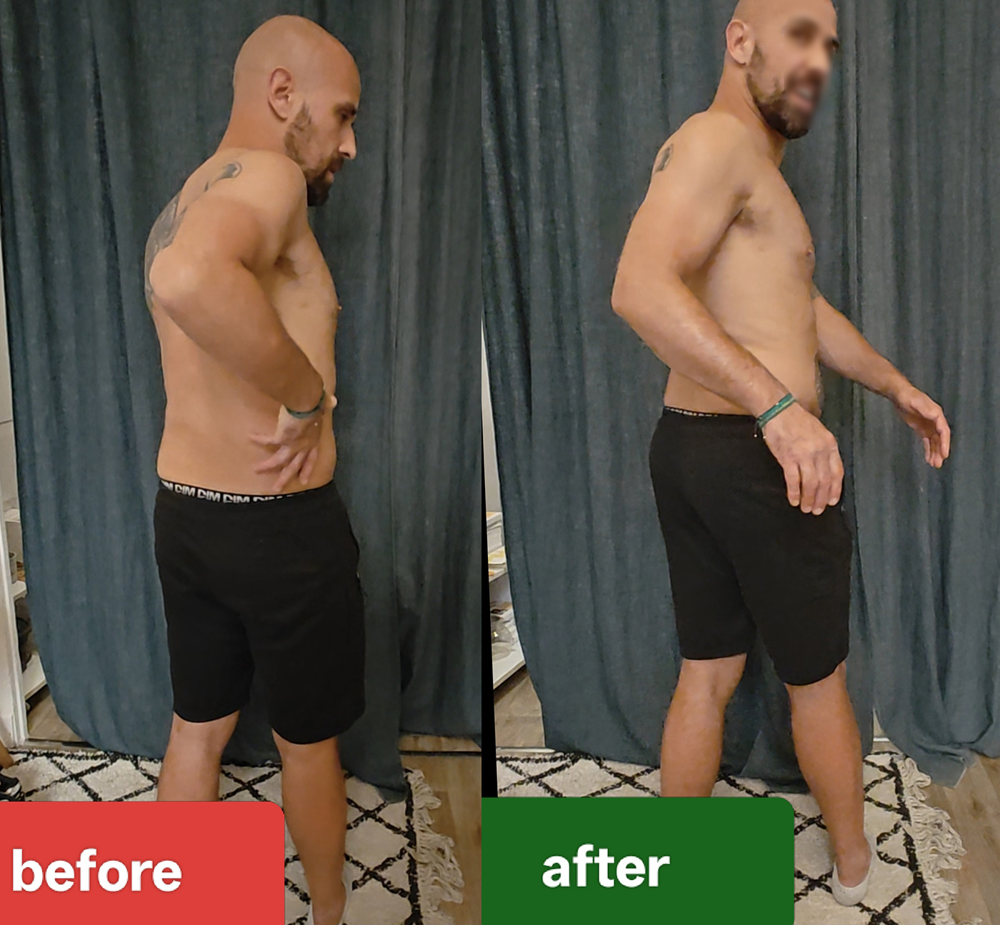 Before and after clinical atlas