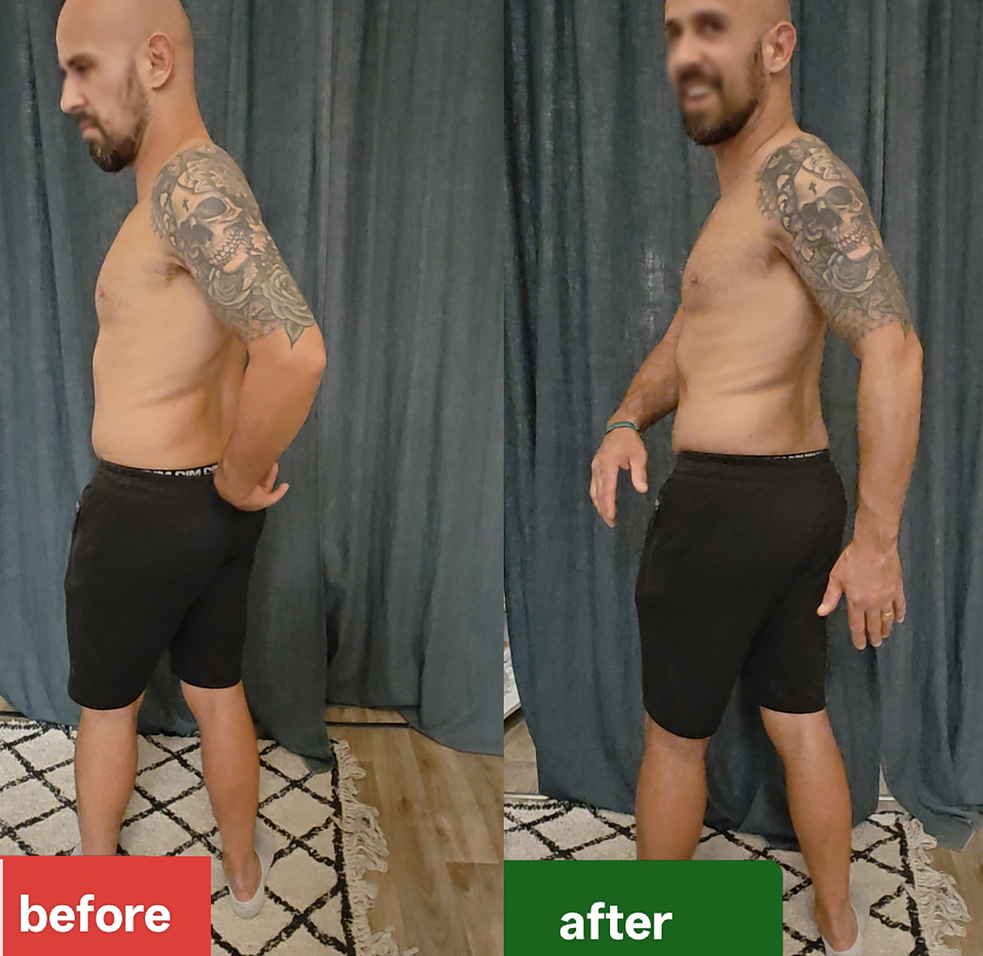 Before and after clinical atlas